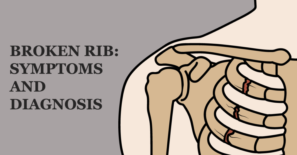 Broken Rib Symptoms and Diagnosis to SYS Medtech