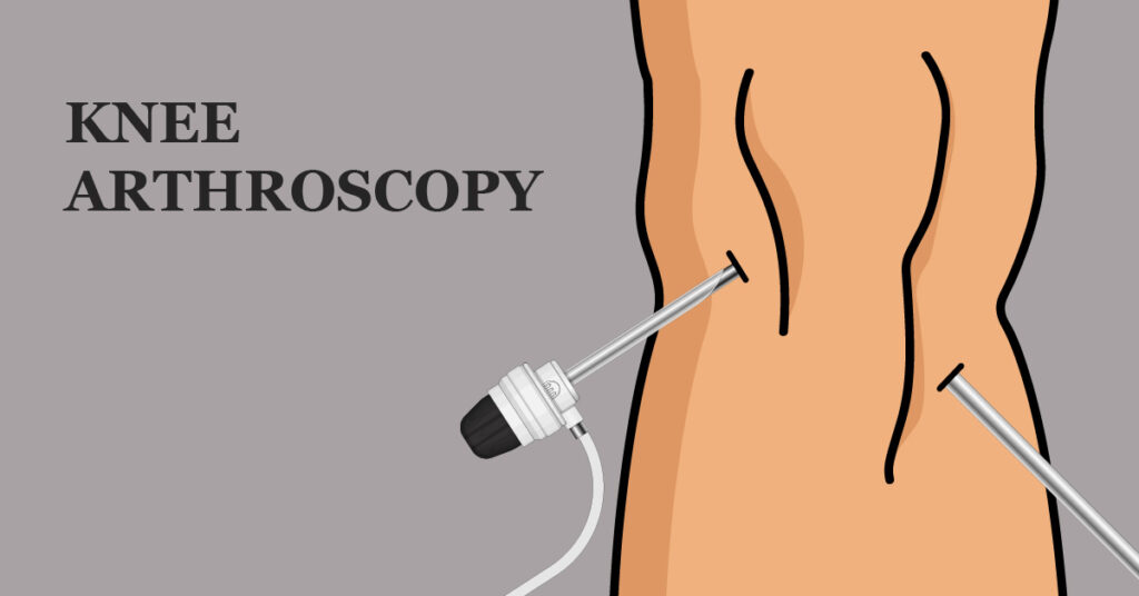 Fundamentals of Knee Arthroscopy to SYS Medtech International