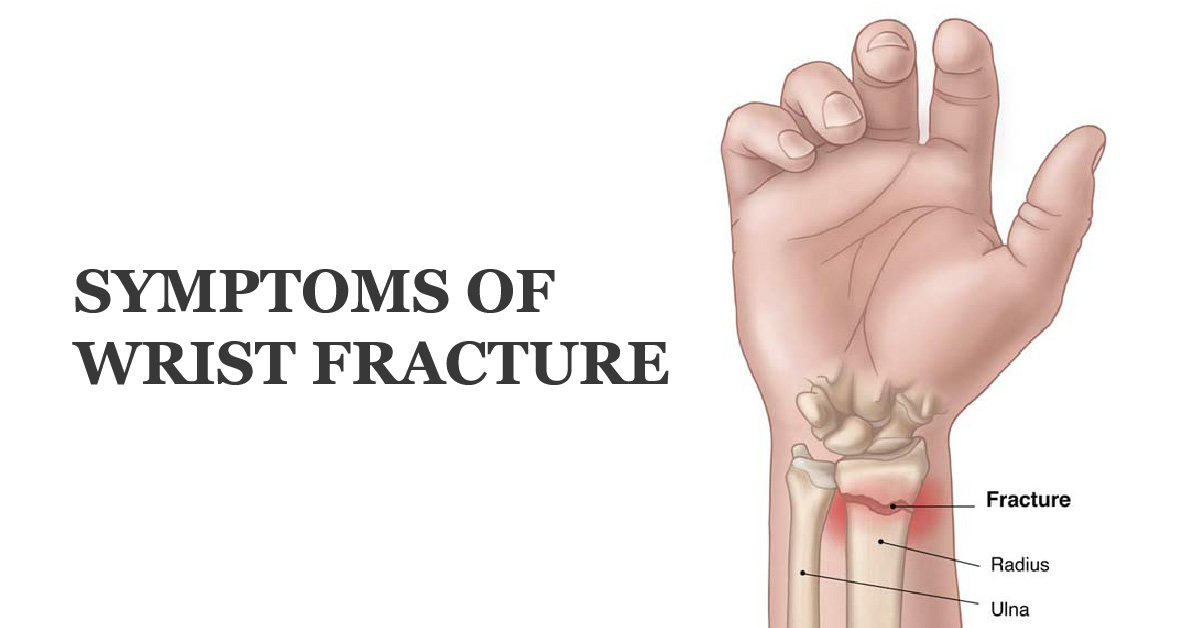 Symptoms of Wrist Fracture – Welcome to SYS Medtech International 