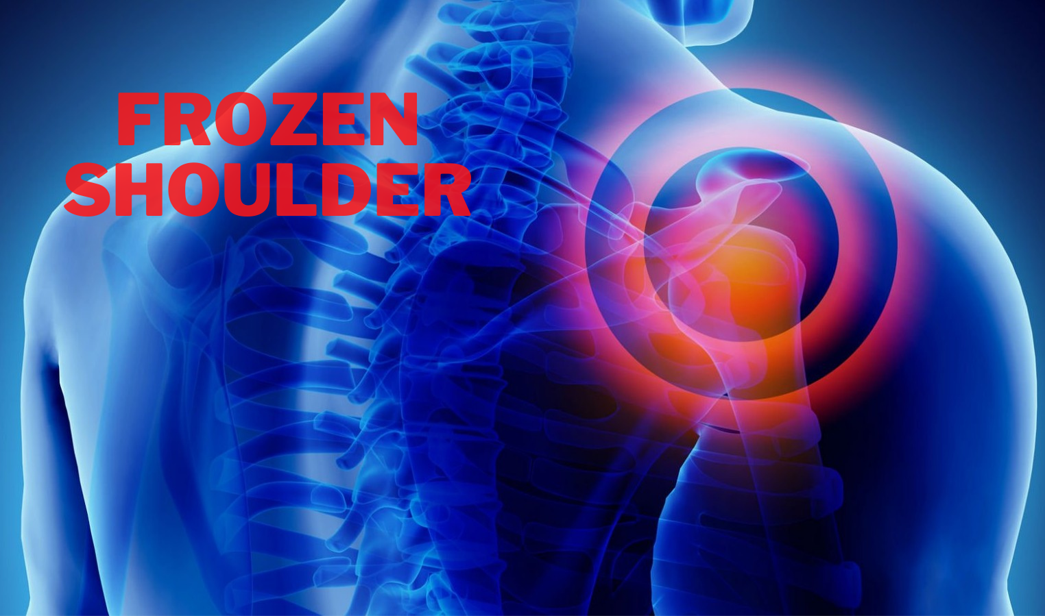 Frozen Shoulder Featured Image
