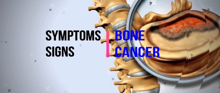 Dont Wait Recognize The Signs Of Bone Cancer - ebpqucv