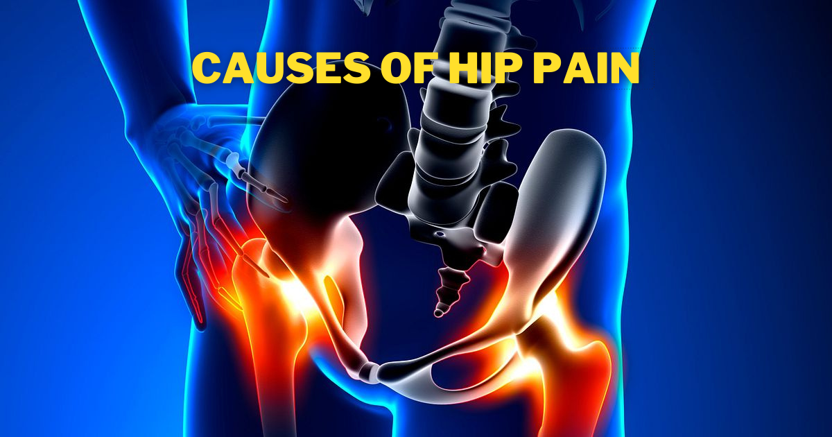 Causes of Hip Pain (Featured Image)