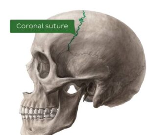 Coronal suture