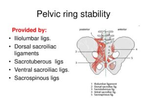 Pelvic ring stability